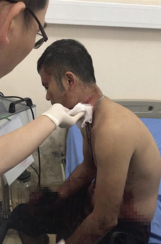 truy bat nhom nghi pham cua co 3 cong nhan hinh anh 1