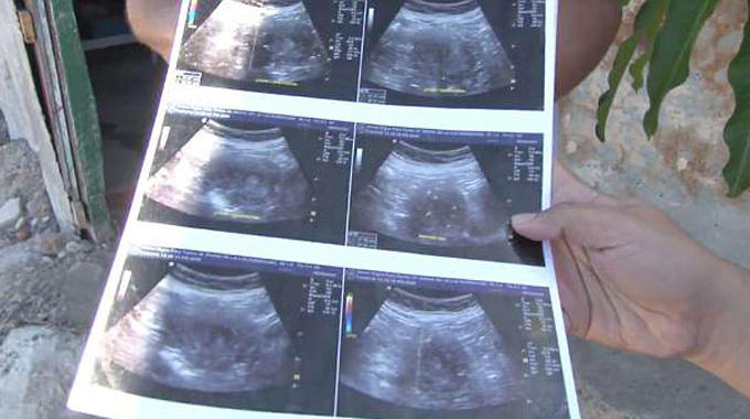 Cụ bà người Mexico khoe ảnh chụp siêu âm để chứng tỏ rằng mình thực sự đang có bầu. Ảnh:CEN/La Republica.