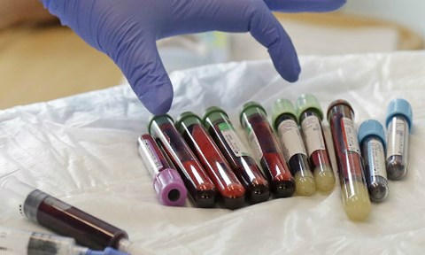 Thuốc chữa ung thư ngày càng quá đắt đỏ