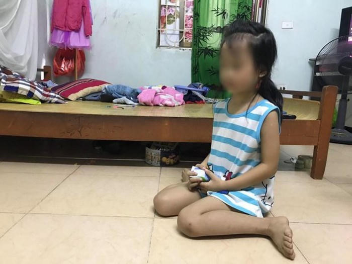 Phẫn nộ: Bé gái mặt dính máu, nghi bị mẹ đánh rồi live stream trên facebook