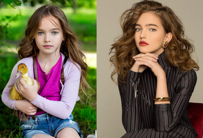 Ngày ấy - bây giờ của các mẫu nhí nổi tiếng thế giới
