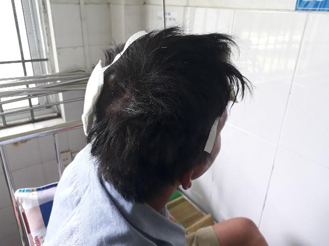 Cãi vã với C. liên quan tỷ lệ kèo khiến anh A. bị chém. Ảnh: CA Quảng Nam.