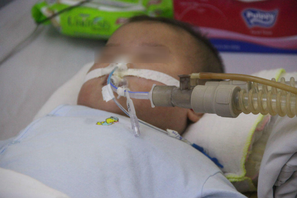 Bác sĩ quay cuồng cấp cứu trẻ nhập viện gấp 5 lần vì tay chân miệng