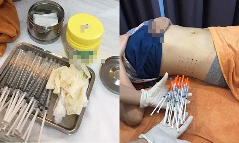 Sự thật đằng sau những ống tiêm tinh chất giảm cân đắt đỏ