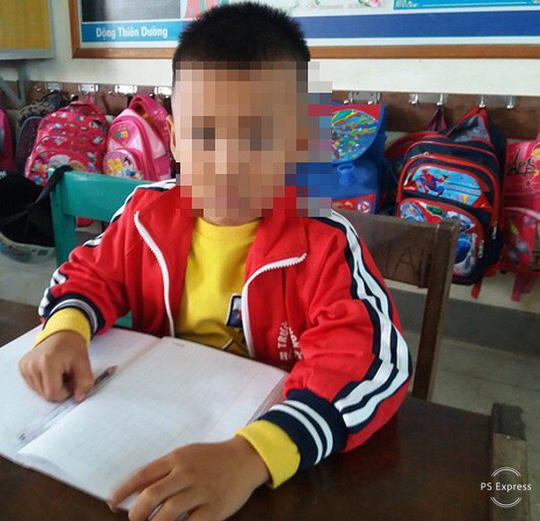 Chép nhầm đề, học sinh lớp 1 bị cô chủ nhiệm tát nhập viện - Ảnh 1.