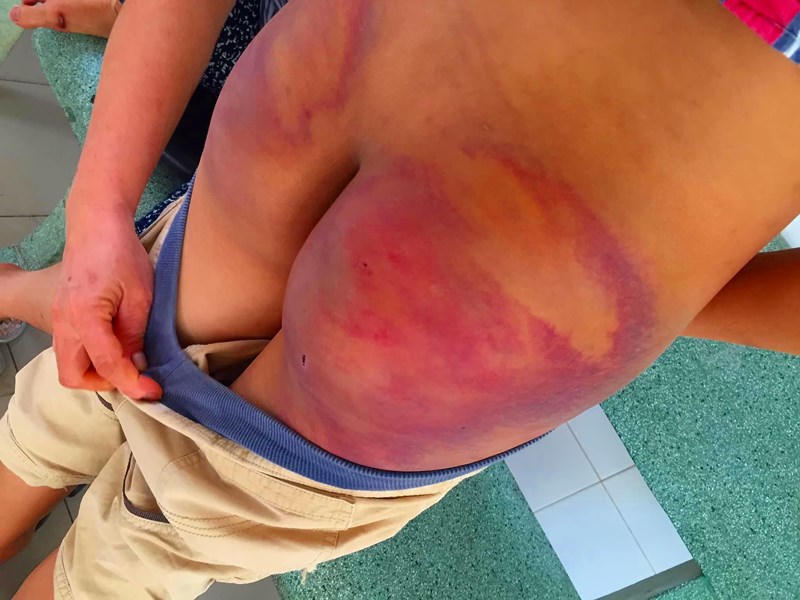 Nghi án bé trai 11 tuổi bị 1 người tu hành ép quan hệ đồng giới, tra tấn dã man