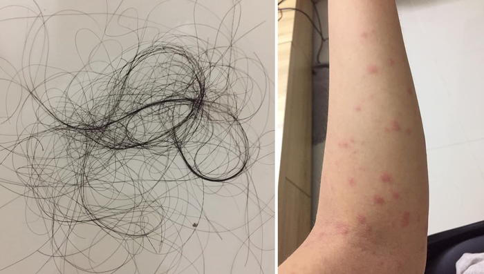 Hình ảnh được cho là tác dụng phụ của thuốc phòng chống lây nhiễm từ người bạn của chị C.T.T.N.