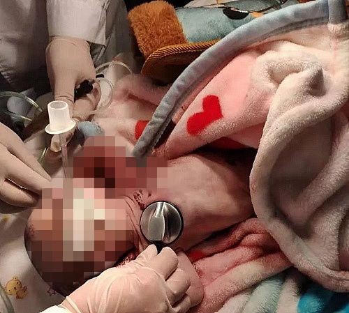 Be so sinh bi me vut trong thung rac hinh anh 1 