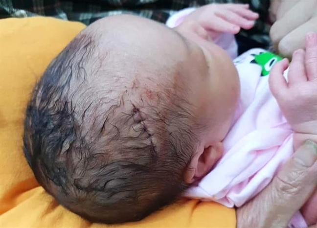 b-trai-phi-khu-6-mi-trn-u-ngay-sau-khi-va-lt-lng-m.jpg b-trai-phi-khu-6-mi-trn-u-ngay-sau-khi-va-lt-lng-m.jpg