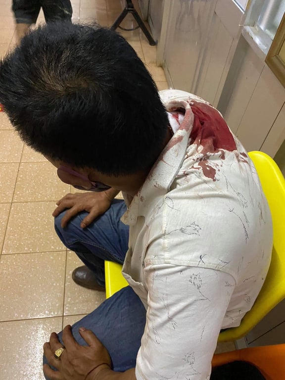 Mang lồng chim đi taxi, khách bị tài xế rút dao đâm nhập viện