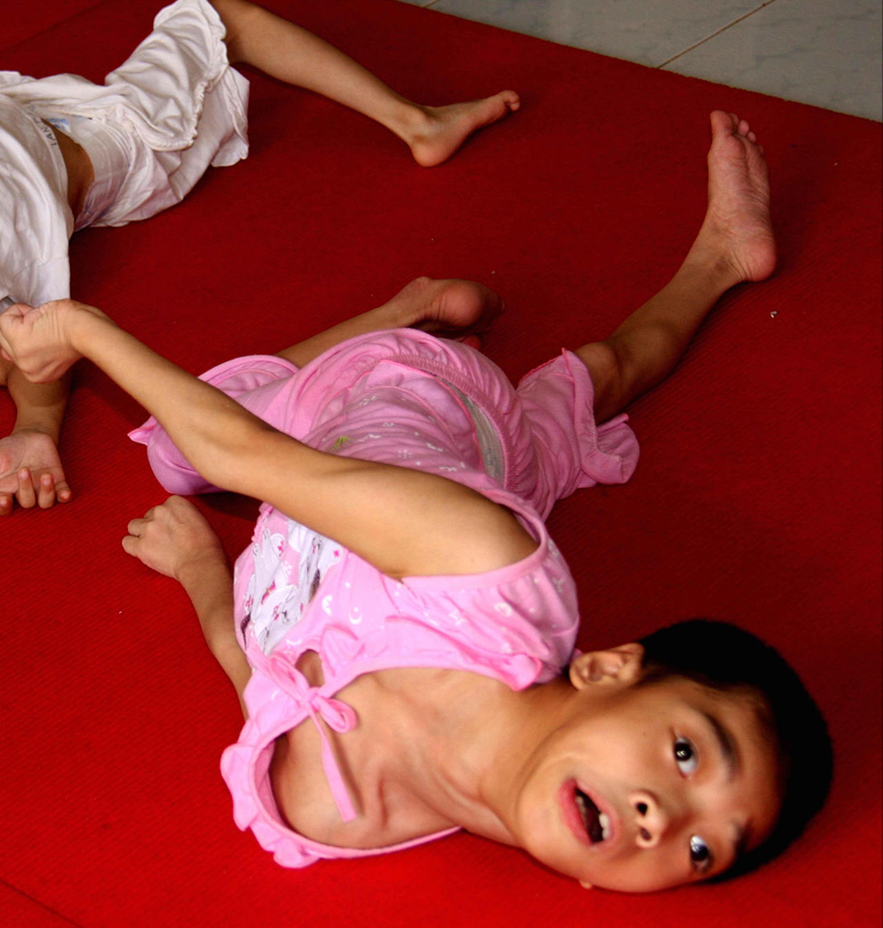 Khắc khoải nỗi đau chất độc da cam