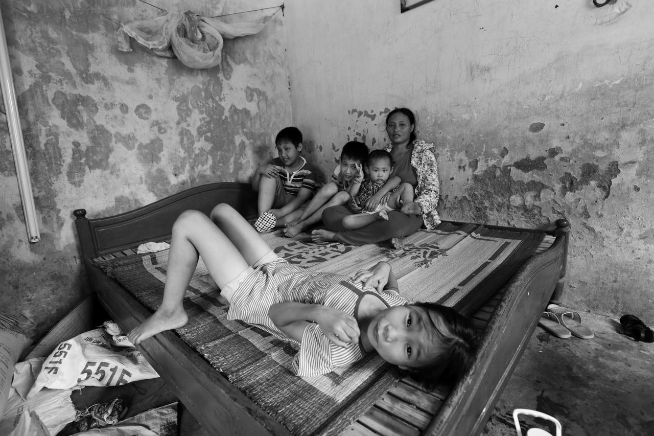 Khắc khoải nỗi đau chất độc da cam