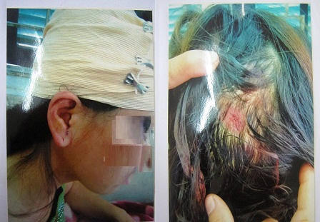 Vụ chiếc dùi đục tưởng tượng ở Bắc Ninh: Luật sư lên tiếng