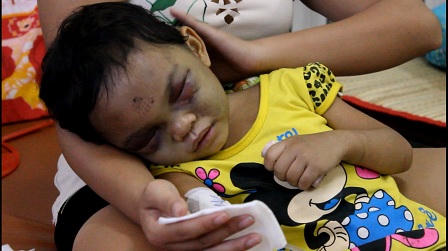 Sốc với nguy cơ stress của cô giáo mầm non