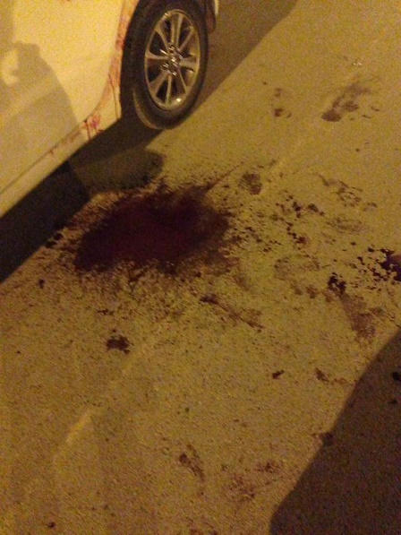 Tài xế taxi bị cứa cổ lúc nửa đêm