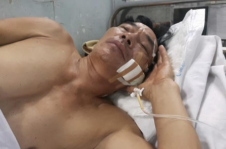 Lời qua tiếng lại, anh rể chém em vợ nguy kịch