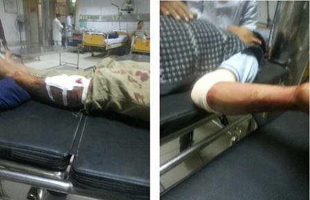 Đang ngồi đánh cờ, nam thanh niên bị 4 đối tượng đánh chém dã man