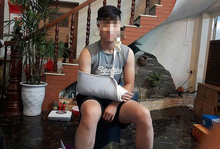 Vụ côn đồ đánh 4 người nhập viện: Chờ công an điều tra, xử lý 