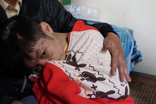 Lời khai rợn người của người cha đánh con trai 10 tuổi gãy xương sườn, rạn xương sọ