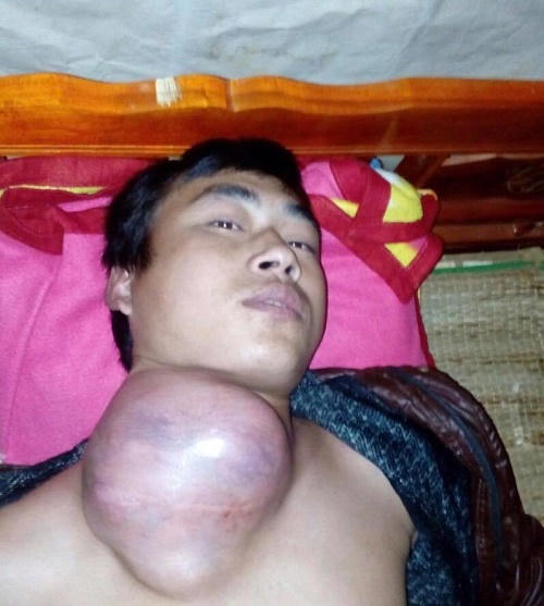 Ước mơ giản dị của người bố trẻ đang chới với trước 'cửa tử'