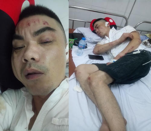 Hà Nội: Bãi giữ xe không phép bị tố “làm loạn khu vực”