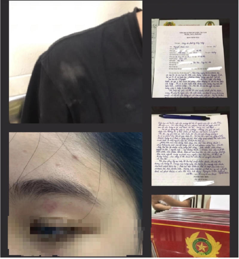 Công an lập biên bản vụ việc nhân viên tiệm bánh mì Nguyên Sinh đánh khách hàng tại Hà Nội