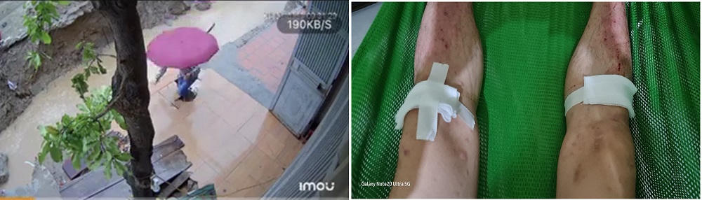 Bắc Ninh: Nhiều bất cập trong việc thực hiện Dự án đường tỉnh 295 huyện Yên Phong