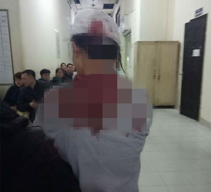 Công an xác định 1 nghi can trong vụ nữ sinh bị đánh nhập viện