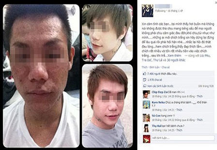 Mỹ phẩm trên mạng xã hội: Hàng "lởm" chui qua lỗ hổng hành lang pháp lý