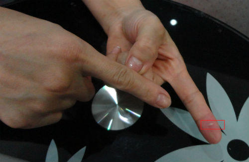 Vụ máy thẩm mỹ HonKon gặp sự cố: Sử dụng đúng kỹ thuật thì… bị điện giật?