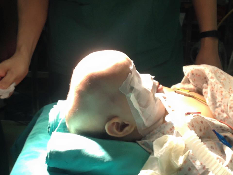 Bệnh viện Xanh Pôn phẫu thuật thành công hộp sọ biến dạng hình thuyền