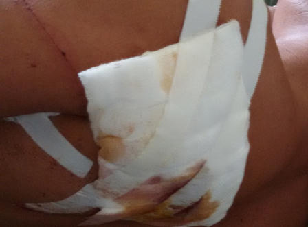 Hà Tĩnh: Vừa ngủ dậy, bị hàng xóm lao vào nhà đâm thấu vai