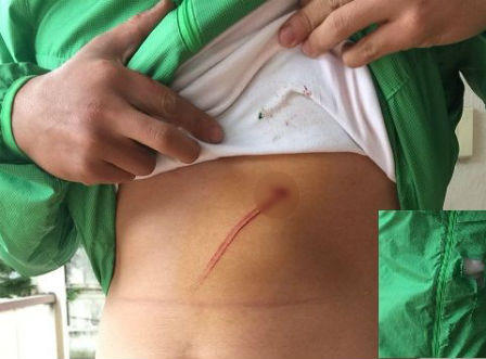 Bị vây bắt, tên trộm dùng hung khí tấn công cảnh sát