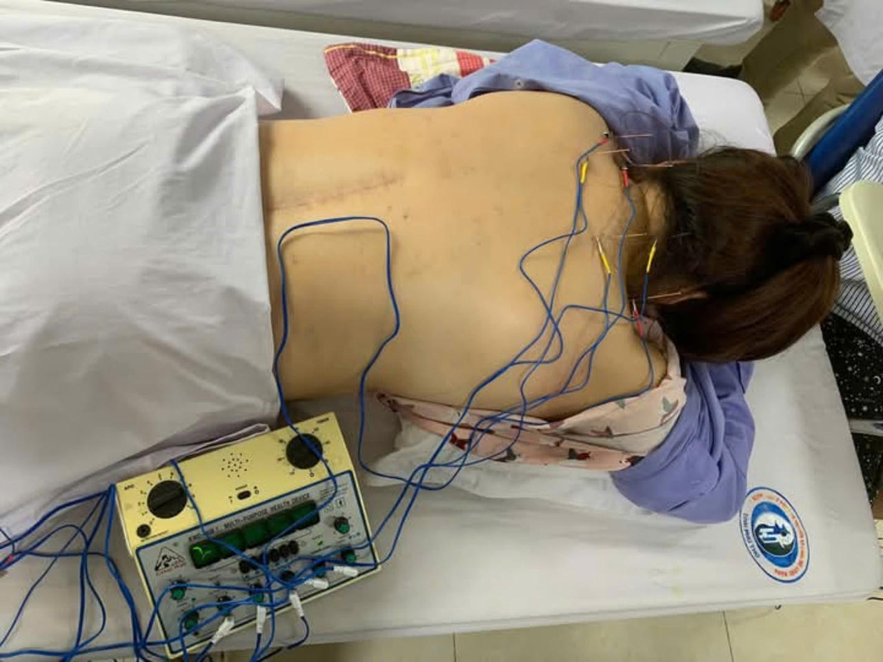 Bệnh viện Y Dược cổ truyền và PHCN tỉnh Phú Thọ áp dụng phương pháp mới phục hồi vận động sau chấn thương cột sống