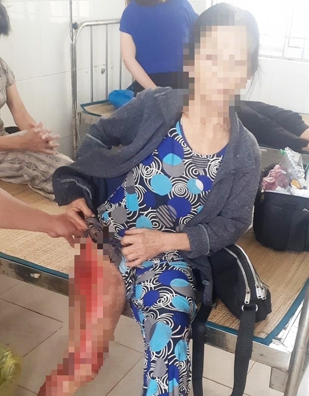 Bắt nữ 'siêu trộm' kéo lê bà bán rau cả chục mét