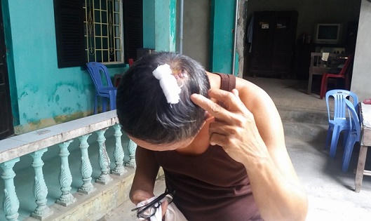 Chủ tịch Chi hội người mù Huế và con trai bị đánh trọng thương 