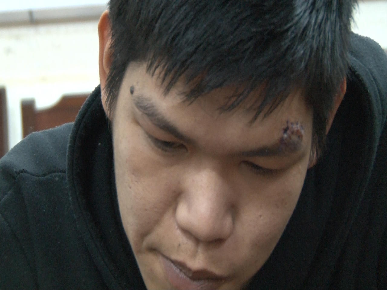 Trộm bị lộ, lao thẳng xe gây thương nặng người phát giác