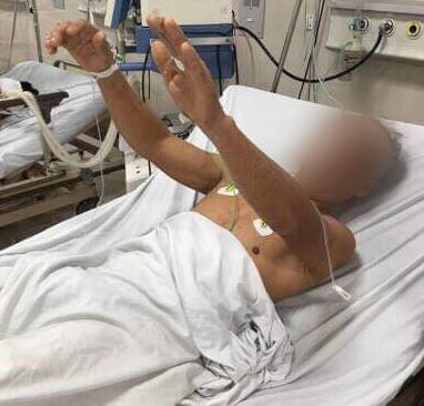 Quảng Bình lần đầu cứu bệnh nhân thoát liệt nhờ thuốc tiêu sợi huyết