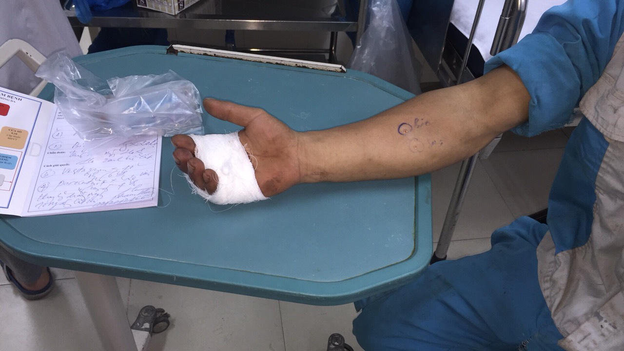 Tình yêu đặc biệt của những người công nhân quét rác