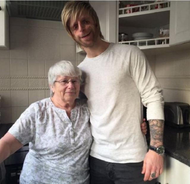 Sinh ra với khuôn mặt “dị”, nghị lực của chàng trai khiến cả thế giới khâm phục