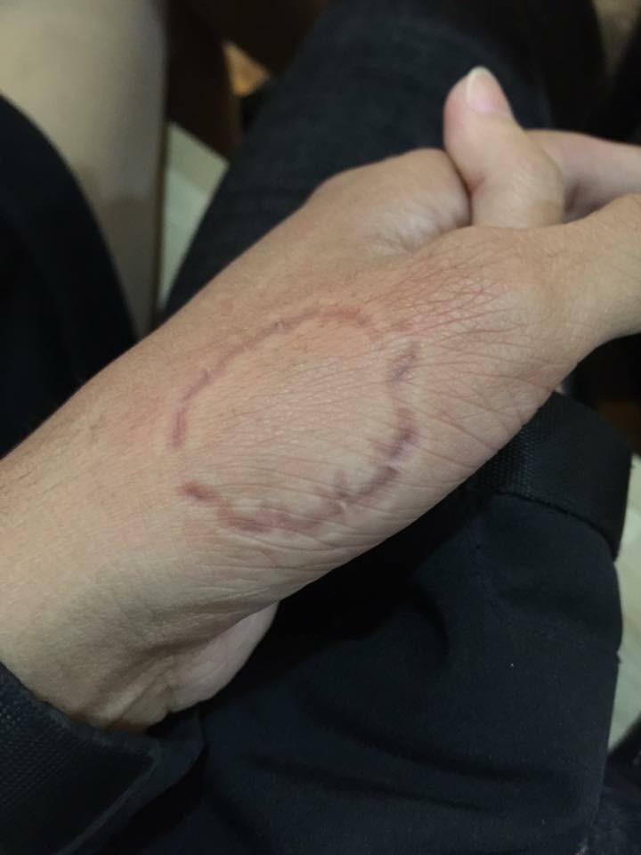 Vết cắn trên tay kẻ quay mặt không dám nhìn bờ biển tố cáo hành vi phạm tội