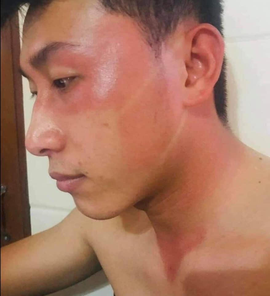 “Rang mình” giữa “chảo lửa” xứ Nghệ kiểm soát dịch 