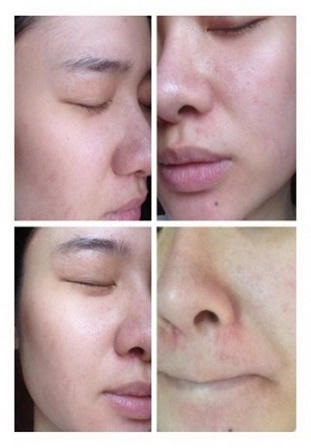 Nhan sắc "nhát ma" vì “thần dược làm đẹp”