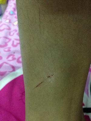 Vụ diễn viên múa tố đại gia Đà Nẵng hiếp dâm: Người bị tố cáo nói gì?