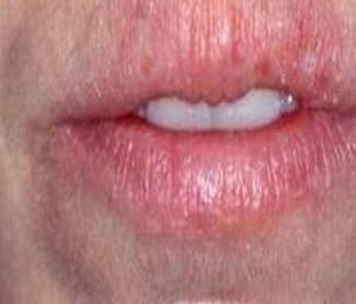 Son tẩy thâm môi loạn giá: Chất lượng đi về đâu?