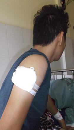 Mâu thuẫn cá nhân, thiếu nữ thuê giang hồ đến tận nhà chém người