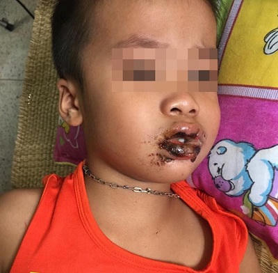 Ai đem bột thông cống vào lớp mẫu giáo khiến 4 trẻ nguy kịch?