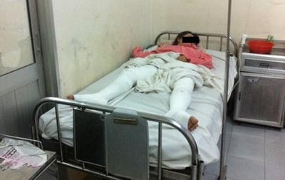 Tưới xăng đốt lò bánh mỳ, 4 người bỏng nặng