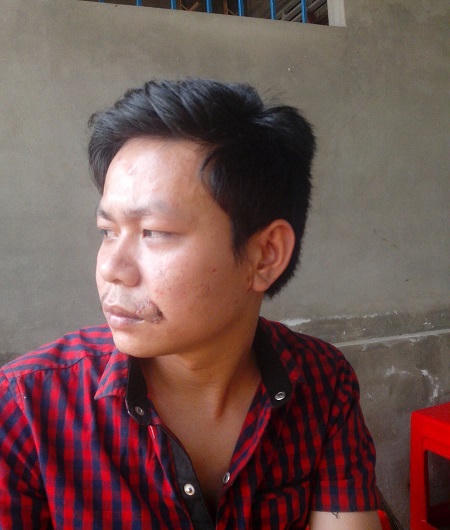 Cán bộ ấp cắn rách môi trai trẻ