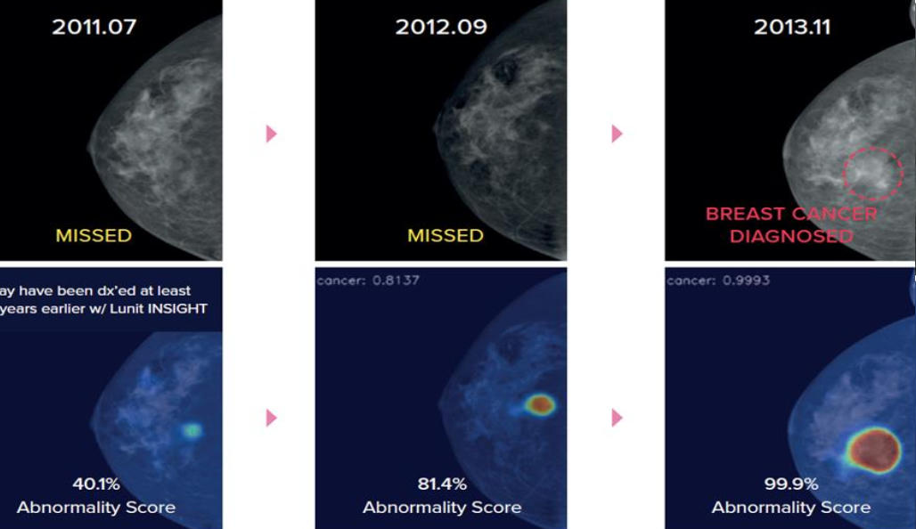Fujifilm và T-Matsuoka triển khai mô hình tầm soát phát hiện sớm ung thư bằng AI